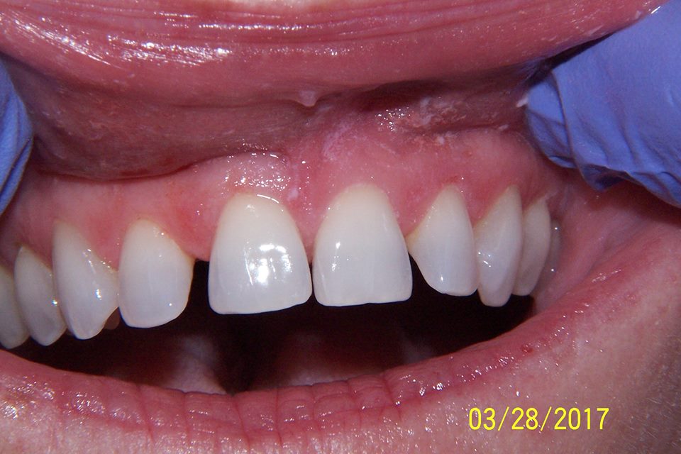 Skyline Family Dental Care Cosmetic Dentistry